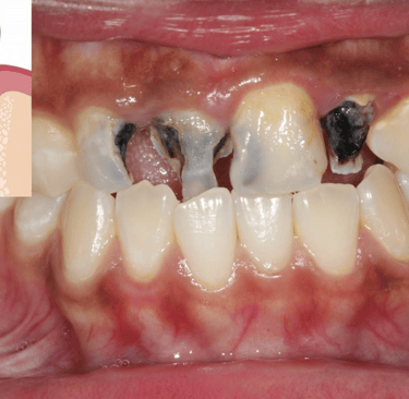dental cares