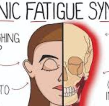متلازمة التعب المزمن ( CFS) التهاب الدماغ النخاعي العضلي ( ME) الصيام والماء البارد