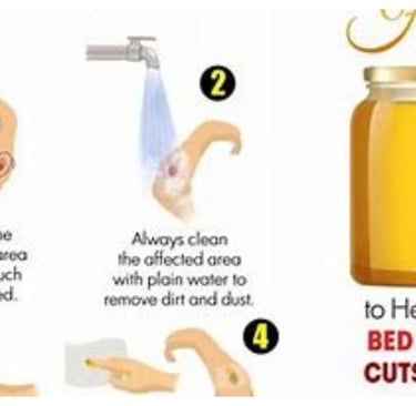 honey use to aleviate pain