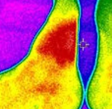 temperature increase (saturated red zone) caused by a bee sting after about 28 hours