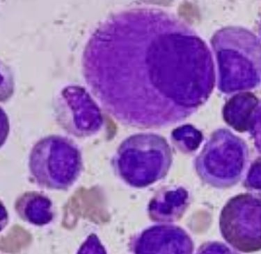 Curable Cancers And Effect Of Voluntary Fasting (4)