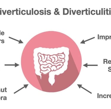 دليل 2026 لفهم العلاقة بين الرتج (Diverticulosis) والصيام: تعرّف على الأخطاء الشائعة التي تزيد الضغط