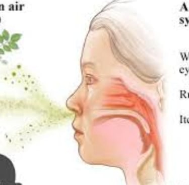 Dr. Hassan Al Warraqi's Approach to Disease Treatments sneezing
