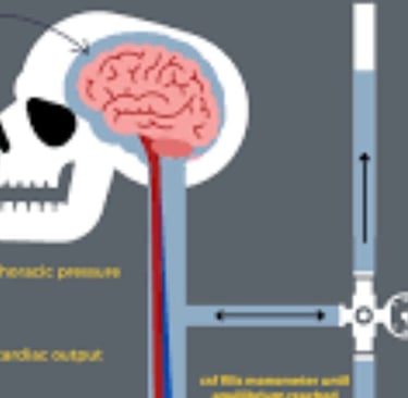 ๐ง ๐ Idiopathic Intracranial Hypertension (IIH) and Voluntary Fasting ๐
