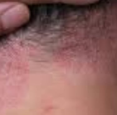 🧬 How Fasting Calms the Immune System in Psoriasis and Eczema