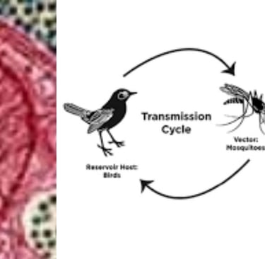 Eastern Equine Encephalitis (EEE)