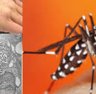 Eastern Equine Encephalitis (EEE)