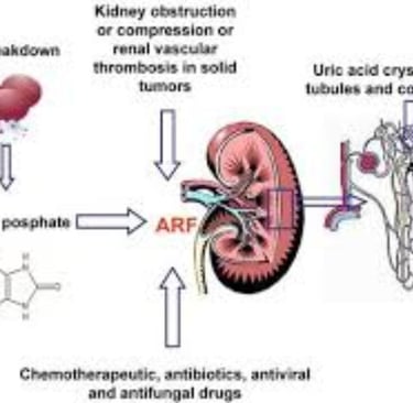 Fasting and Tumor Lysis Syndrome