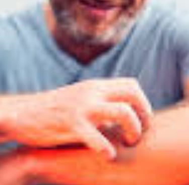Fasting for Skin Allergies, Itching, and Pruritus