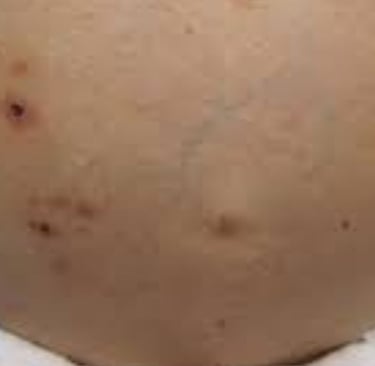 Fasting for Skin Allergies, Itching, and Pruritus