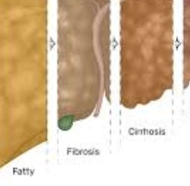 honey good for liver repair inflammation cirrhosis