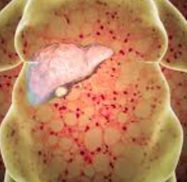 honey good for liver repair inflammation cirrhosis