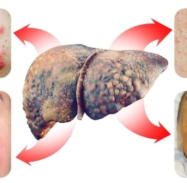 Fatty Liver Disease Can Show Up