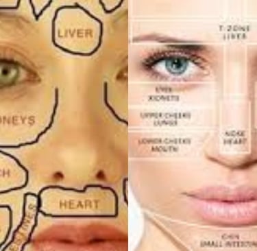 Fatty Liver Disease Can Show Up on Your Face