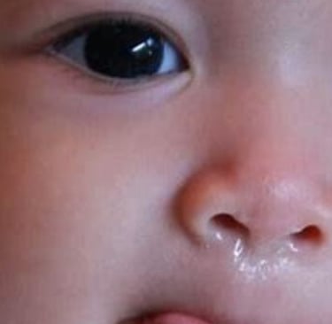 discharge nose