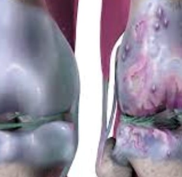 regeneration of cartilage