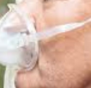  Recurrent Respiratory Infections (RIs)  Health professionals and researchers concerned with recurre