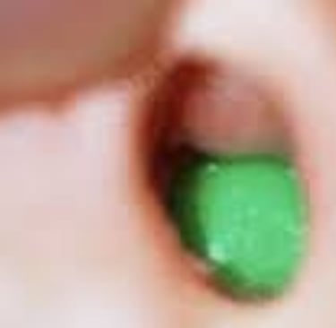 how to remove foreign body from the nose of a child