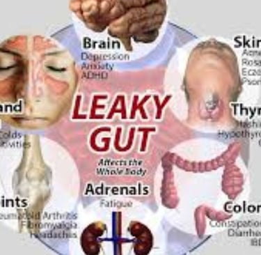 Leaky Gut Syndrome New View to Symptoms, Diagnosis & Treatments 1
