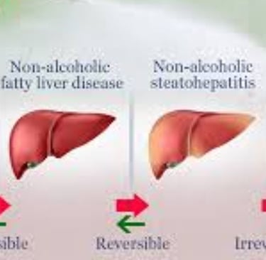 Fatty Liver Disease irreversable cirrosis