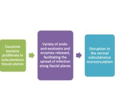 multidisciplinary teams Necrotizing fasciitis2