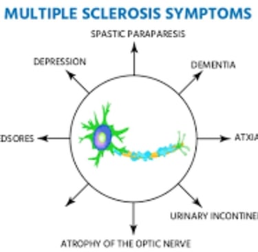 causes & symptoms multiple sclerosis