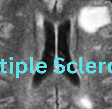 multiple-sclerosis and fasting