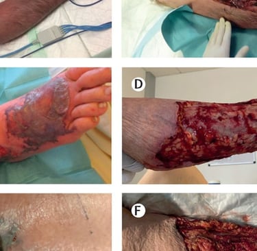treatment lasts for several weeks