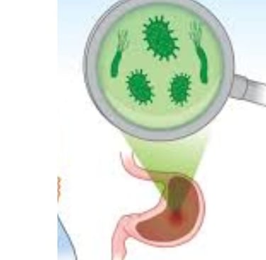 جرثومة المعدة علاج