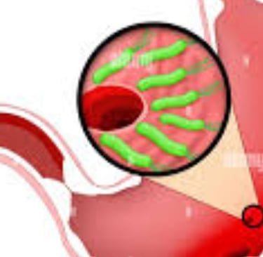 عسل مانوكا لبكتيريا الهيليكوباكتر بيلوري (H. pylori) والصيام