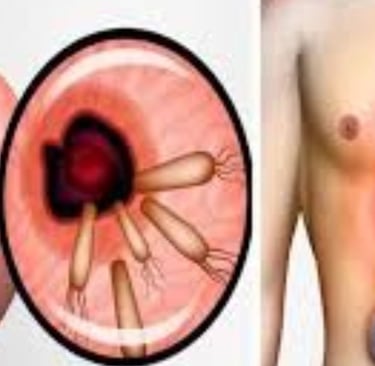 عسل مانوكا لبكتيريا الهيليكوباكتر بيلوري (H. pylori) والصيام