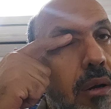 العسل فى العين
