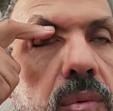 علاج الالتهابات بطريقة الدكتور حسن الورّاقي