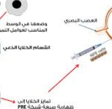 علاج العمى