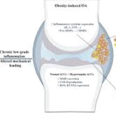 obesity damage the cartilage