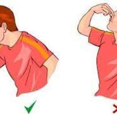 الطريقه الصحيحة وقف النزيف