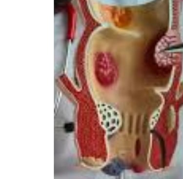 Analgesic properties: Honey relieves pain and itching associated with fissures and fistulas