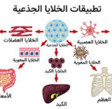احدى طرق العلاج الخلايا الجذعية