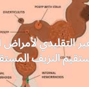 نزيف عبر المستقيم نزيف المستقيم