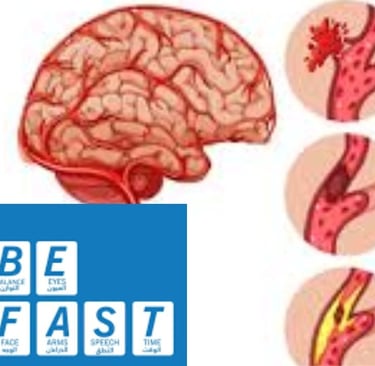 علامات السكته