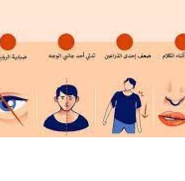 اعراض سكتة الدماغ