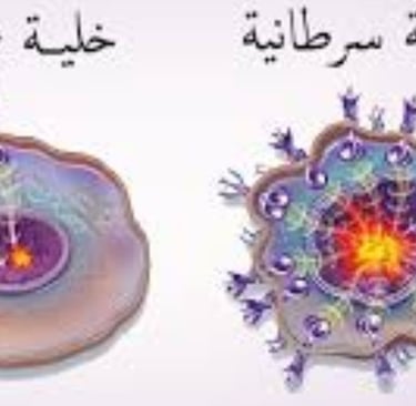 التعرض للمواد المسرطنة