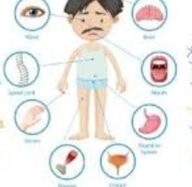 أعراض التصلب المتعدد