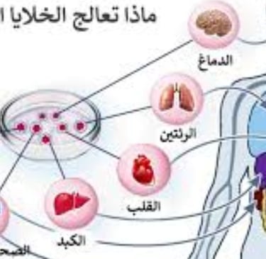 التصلب المتعدد والصيام