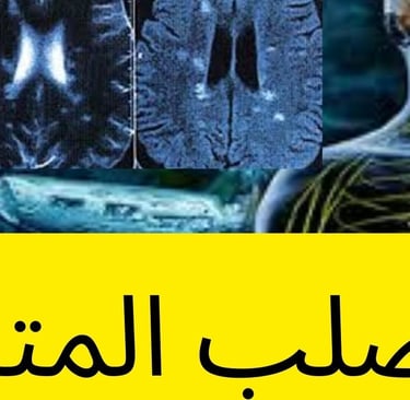 التصلب المتعدد