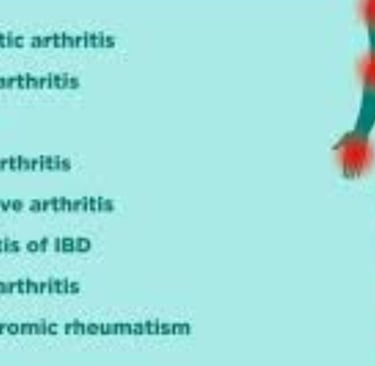 Stages of Rheumatoid Arthritis