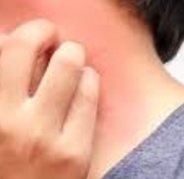 الصيام لعلاج حساسية الجلد الحكة والهرش