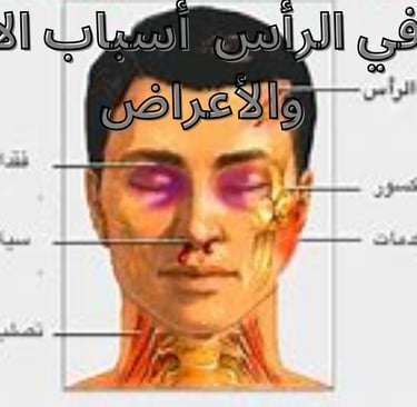 قد يكون أحد أعراض انسداد الدماغ انسداد يمنع التدفق الطبيعي للسائل النخاعي (CSF) في الدماغ يحيط ويح