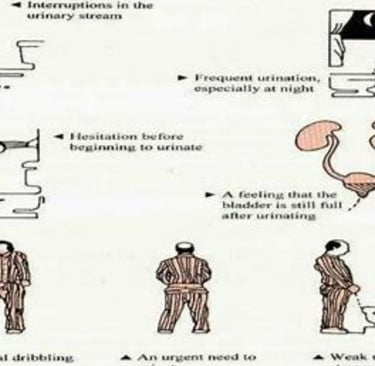 prostatitis