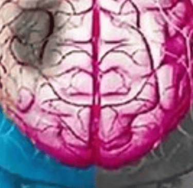what is the best Post-stroke-stroke management